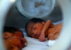 新生児治療室で治療をうける未熟児の赤ちゃん