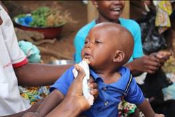 栄養治療食を摂取する男の子