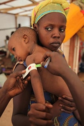 栄養状態の検査を受ける子ども。メジャーが赤色を示し、男の子は栄養不良状態であると診断された。