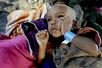 写真：母親に抱えられる、重度の栄養不良の少女。