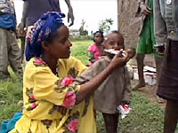 写真：ソマリとオロミアでは急性の重度栄養不良が発生