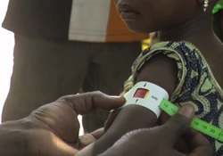 保健員が栄養不良の検査のため子どもの二の腕を測る様子