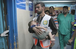 空爆で負傷した子どもを運ぶ医者。子ども35人が死亡、少なくとも296人が負傷した（7月14日時点）
