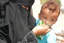 栄養不良の子どもに、すぐに口にできる栄養治療食を与えるイエメンの母親。