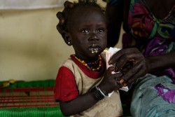 栄養治療食「プランピー・ナッツ」を食べている、南スーダンの子ども。
