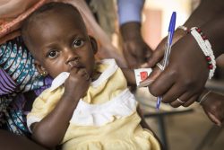 トンブクトゥの保健所で上腕周囲径測定帯（MUAC）を使った栄養不良の検査を受ける生後6カ月のアイチャトゥちゃん。(マリ、2020年3月撮影)