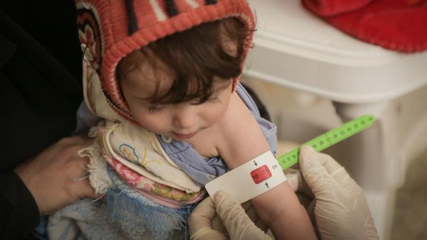 イエメン 極度の食料不安 IPCフェーズ5、ユニセフなど警鐘