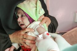 上腕計測メジャーによる栄養不良の検査を受ける生後7カ月のラワビちゃん。(2020年12月撮影)