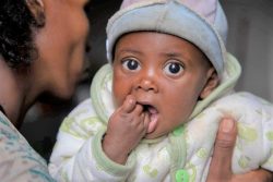 ティグライ州南部で行われたユニセフの栄養状態チェックで、重度の栄養不良と診断され、RUTF(すぐに食べられる栄養治療食)を受け取った生後6カ月の赤ちゃん。(2021年7月20日撮影)