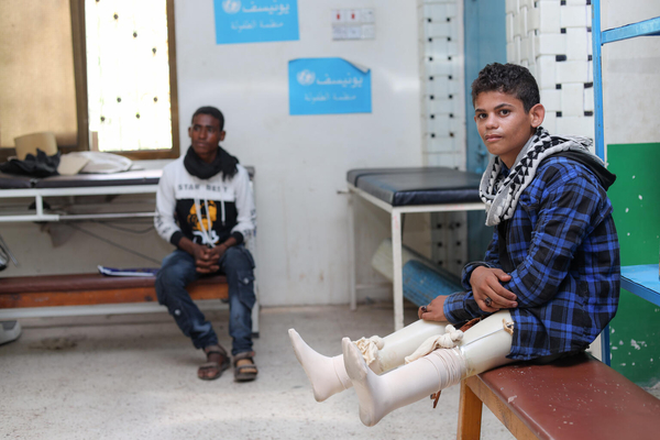 地雷を踏み両足を失った17歳のイブラヒムくん。手術を受け、義足を装着し歩けるようになった。(2021年10月14日撮影)