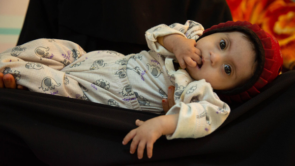栄養不良で首都サヌアの病院に入院している、生後10カ月のハウラちゃん。(2021年10月10日撮影)
