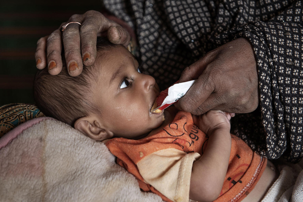 ユニセフが支援する移動式保健・栄養チームによる健康診断で、重度の急性栄養不良と診断され、すぐに食べられる栄養治療食(RUTF)を口にする生後9カ月のアフマドちゃん。(アフガニスタン、2021年11月18日撮影)