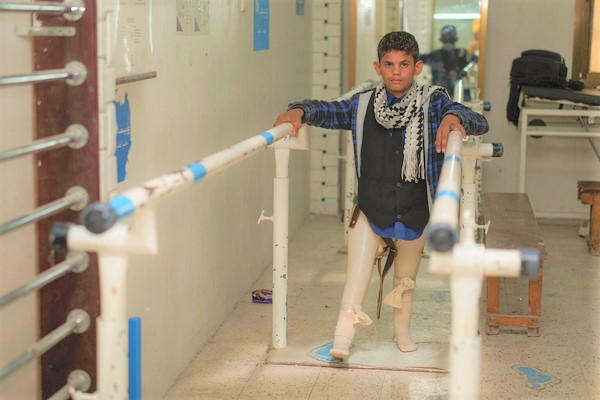 地雷を踏み両足を失った17歳のイブラヒムくん。手術を受け、義足を装着して歩く練習をしている。(2021年10月撮影)