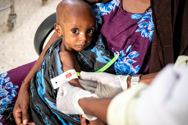 上腕計測メジャーを使って検査を受け、栄養不良と診断された1歳のサルマンちゃん。(ソマリア、2022年2月5日撮影)
