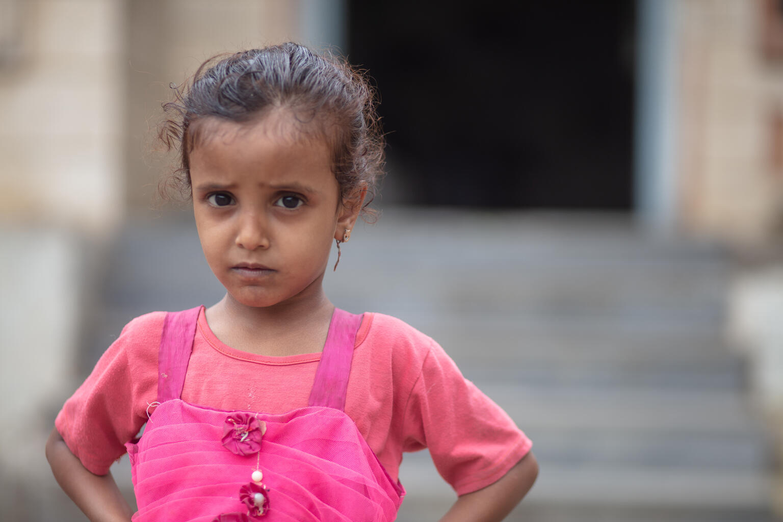イエメンのハッジャ州にあるユニセフが支援する栄養治療センターで、栄養不良の治療を受けている4歳のロワイダちゃん。紛争の影響でイエメンの子どもの栄養状態は悪化している。(イエメン、2021年7月撮影)