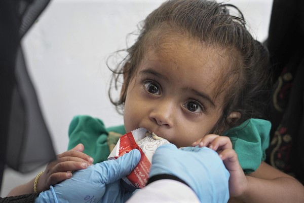 ハッジャ州の移動診療所で、すぐに食べられる栄養治療食(RUTF)を口にするマラムちゃん。(イエメン、2021年11月撮影) 