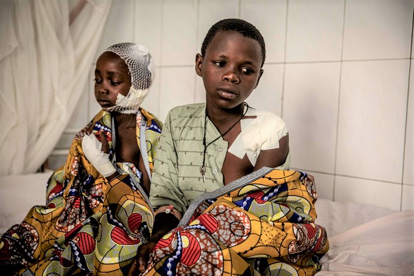 暴力行為によって傷を負った7歳のロシンヌさんと13歳のセシルさん。(コンゴ民主共和国、2022年2月撮影)