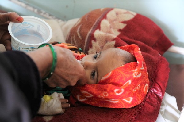 重度の急性栄養不良に苦しむ生後18カ月の赤ちゃん。カンダハールにある病院で治療を受けている。(アフガニスタン、2022年1月撮影)