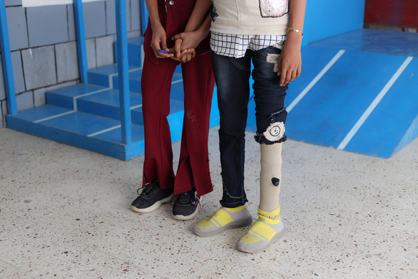 義足を試着する女の子。突然爆撃を受け片足を失った。(イエメン、2021年10月撮影)※本文との直接の関係はありません