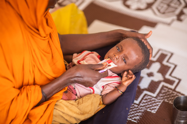 栄養不良の診断を受け、すぐに食べられる栄養治療食(RUTF)を口にする子ども。干ばつの影響で家を追われ、国内避難民キャンプで暮らしているときに、ユニセフの保健・栄養チームの診察を受けた。(エチオピア、2022年4月撮影)