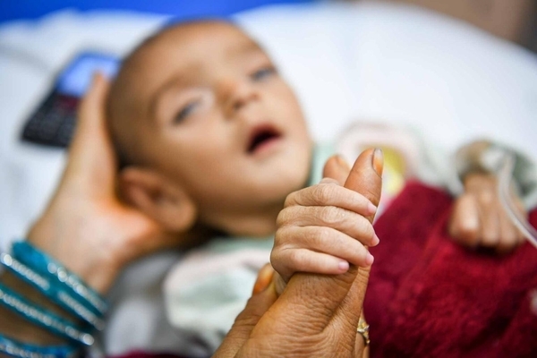 カブールにある病院で、重度の急性栄養不良の治療を受けるため入院している子ども。(アフガニスタン、2022年1月撮影)
