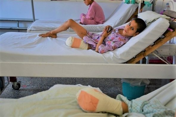 不発弾を踏み片足を失い、カブールの小児科病棟で治療を受ける11歳の男の子。(アフガニスタン、2022年1月撮影)