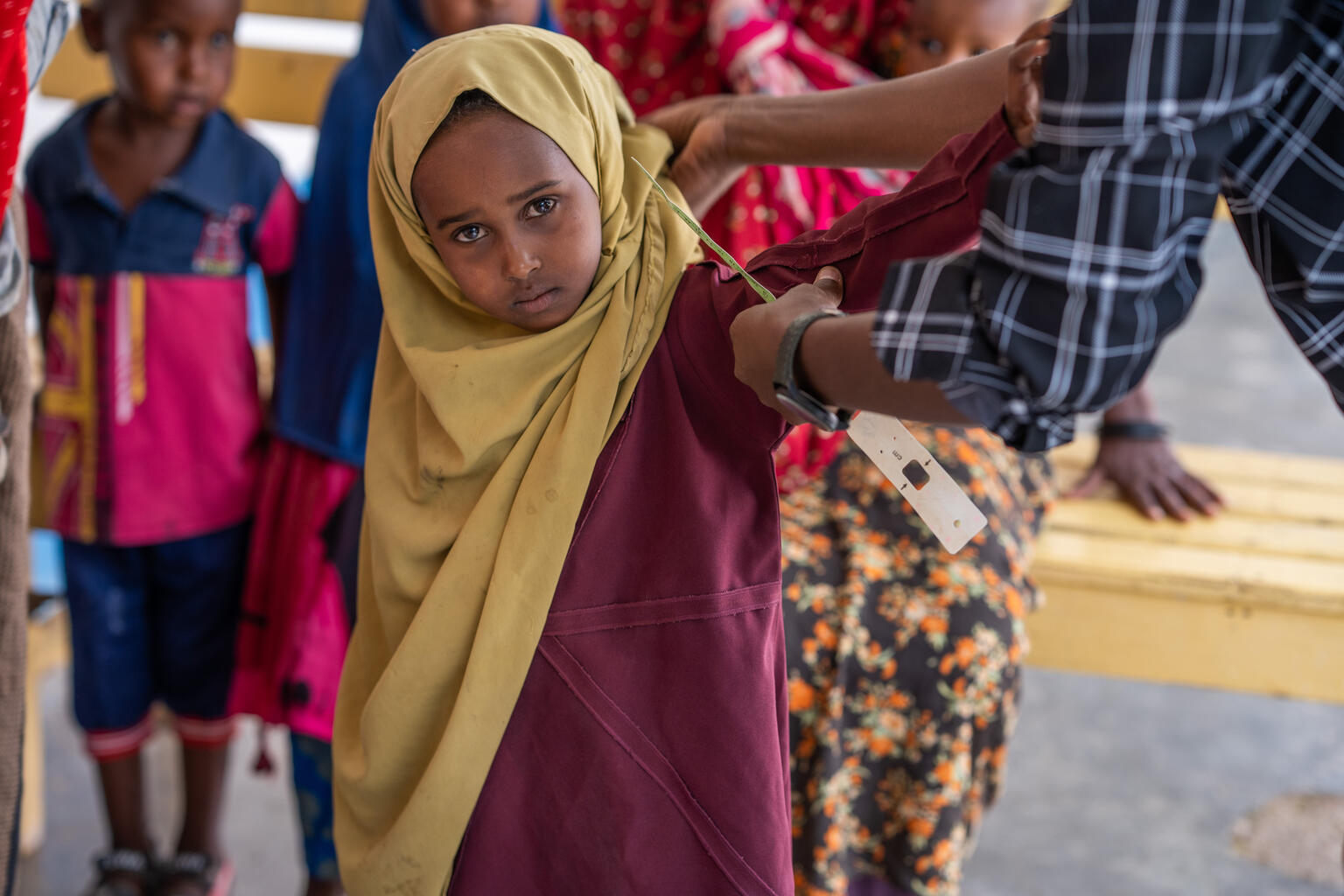 保健センターで栄養不良のチェックを受けるアイシャちゃん（4歳）。干ばつが続き、コレラやはしかの脅威が高まる中、子どもたちは命にかかわるリスクに直面している。（ソマリア、2022年6月20日撮影）