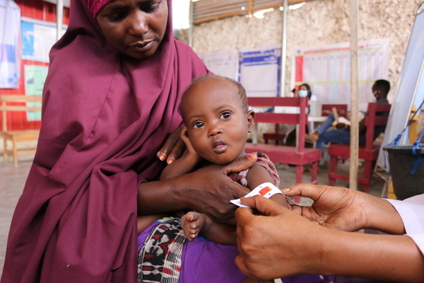 首都モガディシュの農村部にあるユニセフが支援する保健センターで、上腕計測メジャーを使った栄養検査により、重度の栄養不良状態であることを示す「赤色」が示された、2歳のサビリンちゃん。(ソマリア、2022年10月4日撮影)