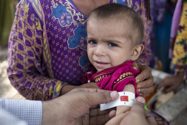 シンド州で、上腕計測メジャーを使った栄養検査で「赤」が示された重度の栄養不良の1歳のサナムちゃん。(パキスタン、2022年9月26日撮影)