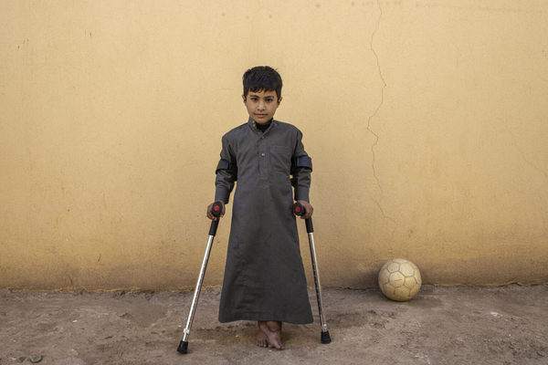 ファルージャで、友達と遊んでいる時に不発弾の破片が爆発し、足を負傷したため松葉杖を使う8歳のディアブさん。爆発により耳が聞こえにくくなり、今も耳が痛む。(イラク、2022年2月撮影)