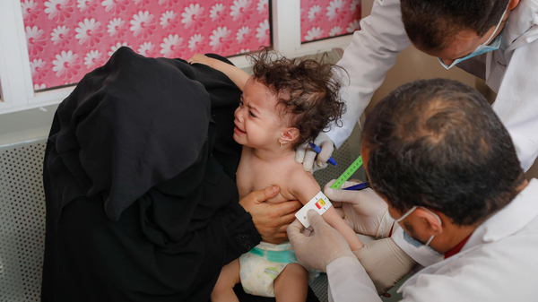 病院で、上腕計測メジャーを使った栄養検査を受ける生後8カ月のジャナちゃん。(イエメン、2022年12月撮影)