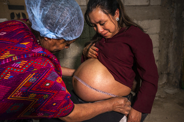 妊婦健診で、腹部の計測を受ける妊娠6カ月のソニアさん。(グアテマラ、2022年10月29日撮影)