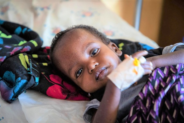 病院の栄養治療センターで、重度の栄養不良に加え、マラリア感染と肺炎の診断を受けたグヨちゃん。オロミア州のボレナでは、干ばつの影響で飢餓や栄養不良になる子どもが増加している。(エチオピア、2023年2月21日撮影)