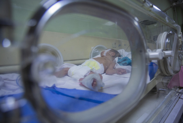 首都バグダッドの病院で、早産で生まれたため人工呼吸器をつけ保育器の中で治療を受ける生後28日のモハメドちゃん。(イラク、2023年4月30日撮影)