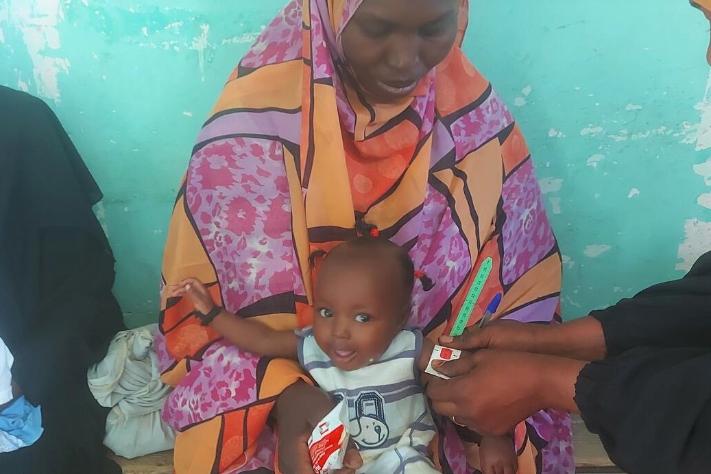 上腕計測メジャーを使った栄養検査で、栄養不良と診断された子ども。(スーダン、2023年5月1日撮影)