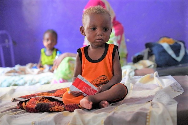 青ナイル州から逃れてきた重度の急性栄養不良で1歳のマフディーちゃん。避難先の小児科病院で、すぐに食べられる栄養治療食(RUTF)を受け取り、食欲検査を受けている。(スーダン、2023年7月3日撮影)