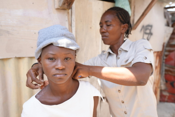 家の近くで銃撃戦があり、家の中で流れ弾に当たり肩を負傷した13歳のバージニアさん。(ハイチ、2023年3月撮影)