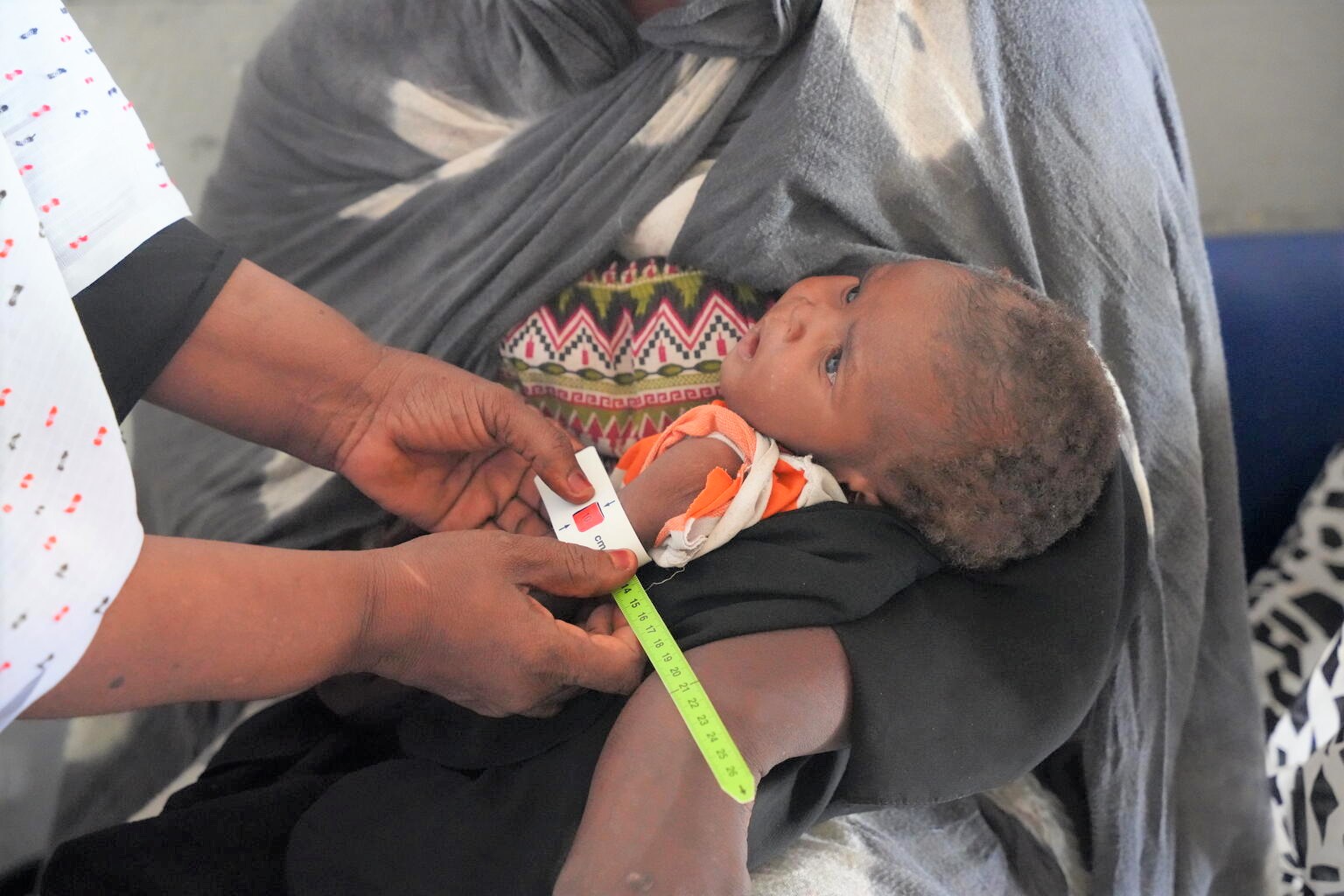 保健センターで、上腕計測メジャーを使った検査により栄養不良と診断された生後8カ月のモハメドちゃん。ハルツームから逃れてきた母親は「母乳が出なくなってしまった」と話す。(スーダン、2023年7月4日撮影)