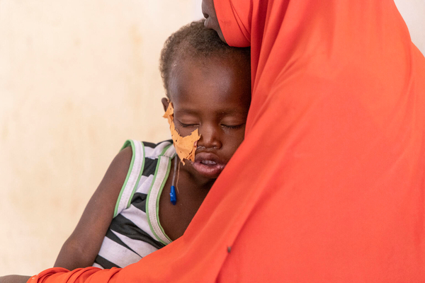 病院の集中栄養回復センターで治療を受ける、重度の急性栄養不良の1歳のラウアリちゃん。(ニジェール、2023年3月撮影)