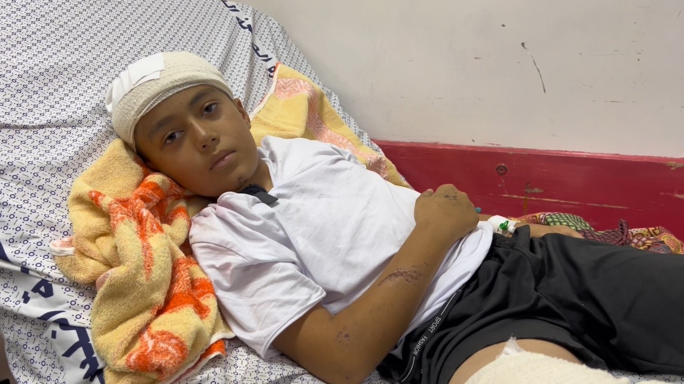 砲撃により飛んできたがれきの破片が当たり、足を骨折し頭を損傷した11歳のリアスさん。アルシファ病院で、治療を受けている。(ガザ地区、2023年10月28日撮影)