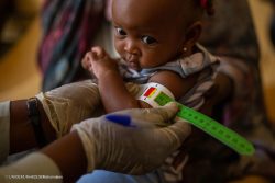 ジャジーラ州の8カ所にあるユニセフが支援する国内避難民キャンプで、上腕計測メジャーを使った栄養検査を受け、重度の栄養不良と診断された生後10カ月のアマニちゃん。(スーダン、2023年10月18日撮影)