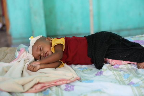 栄養不良のため入院し、治療を受ける生後7カ月のモハマドちゃん。(エチオピア、2023年5月撮影)