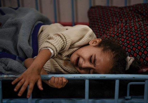 戦闘に巻き込まれ脚を負傷した4歳のガザールちゃん。自宅が戦車に囲まれていたため病院に行けず、隣の家の医師に応急処置をしてもらったが、ナセル病院に到着した時には化膿しており、脚を切断することとなった。(ガザ地区、2023年12月6日撮影)