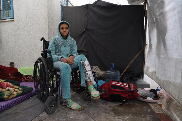 ハンユニスの工業地帯にある避難所で生活する13歳のメイズさん。身体は火傷を負い、脚は骨折し、避難途中には兵士に押さえつけられたため、顔の神経が損傷し、一部に麻痺が生じ、上手く会話ができないという。(ガザ地区、2024年1月11日撮影)