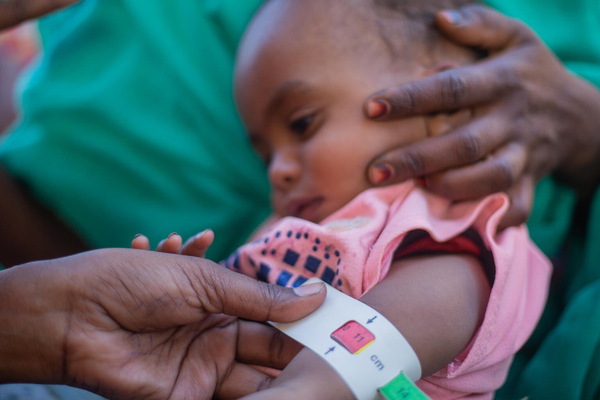リバーナイル州で5歳未満児を対象とした栄養検査を受ける2歳のアイーダちゃん。上腕計測メジャーを使った検査で重度の栄養不良の「赤」が示され、早急な治療を必要としている。(スーダン、2024年2月29日撮影)