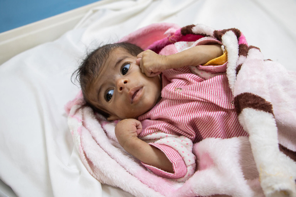 サアダの総合病院で、栄養治療を受ける生後7カ月のリナちゃん。(イエメン、2024年2月18日撮影)