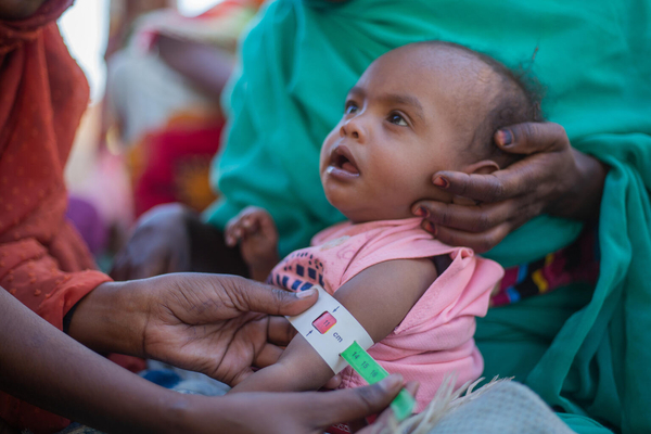 リバーナイル州で5歳未満児を対象とした栄養検査を受ける2歳のアイーダちゃん。上腕計測メジャーを使った検査で重度の栄養不良の「赤」が示され、早急な治療を必要としている。(スーダン、2024年2月撮影)