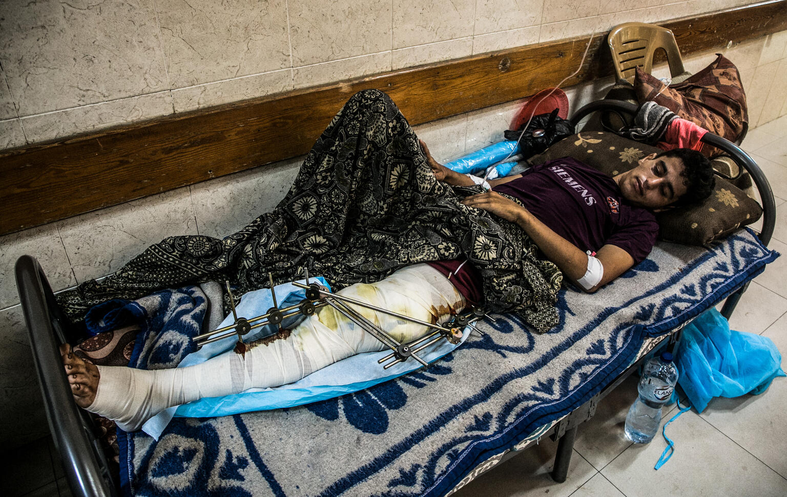 家族のために食料を手に入れようと、何時間も歩いて支援物資の配布拠点まで来たところ、空爆によりけがをした17歳のビラルさん（パレスチナ、2025年7月15日撮影）