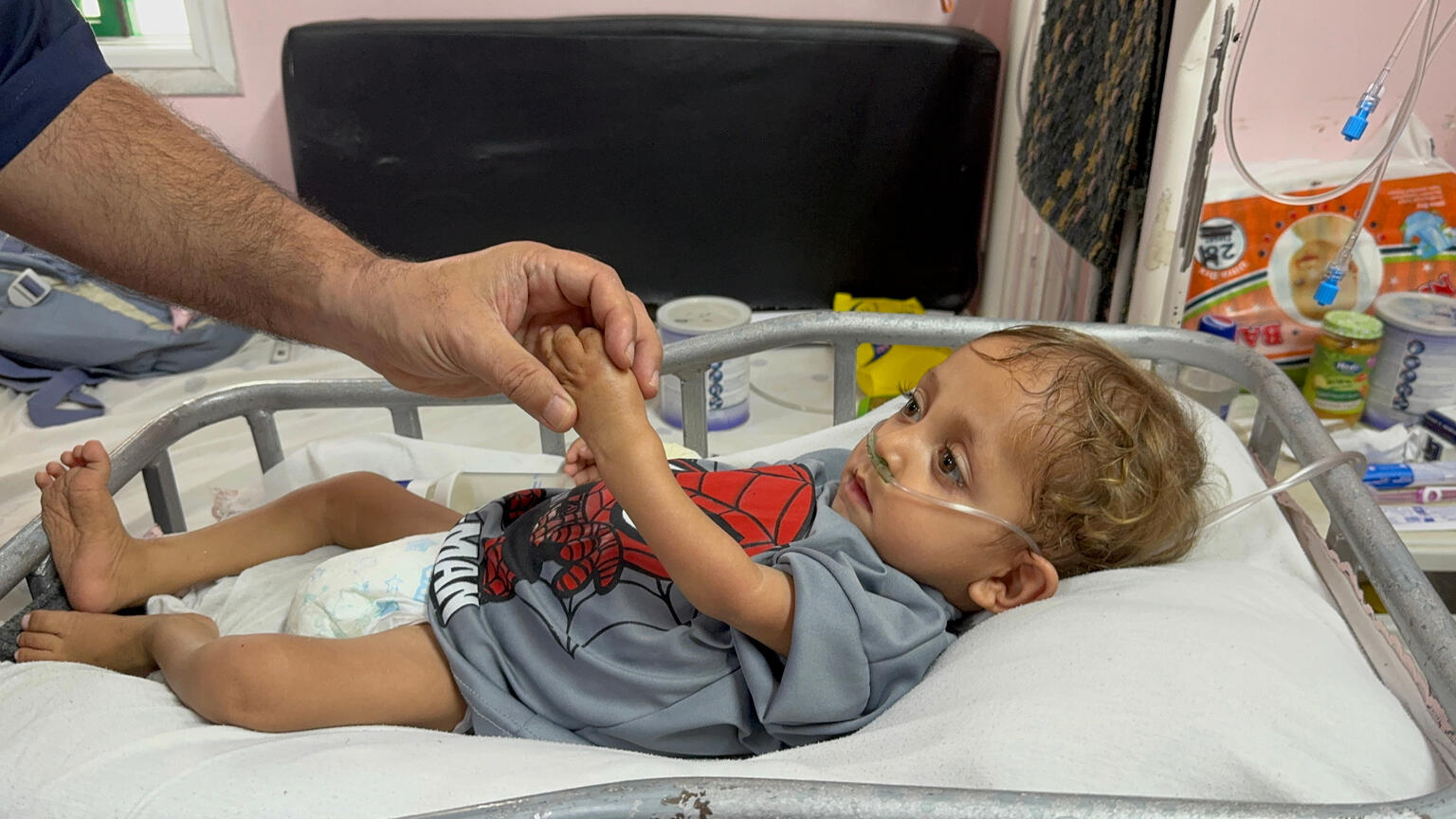 ガザ地区南部のハンユニスにある病院で、治療を受ける3歳のハサンちゃん（パレスチナ、2025年6月5日撮影）