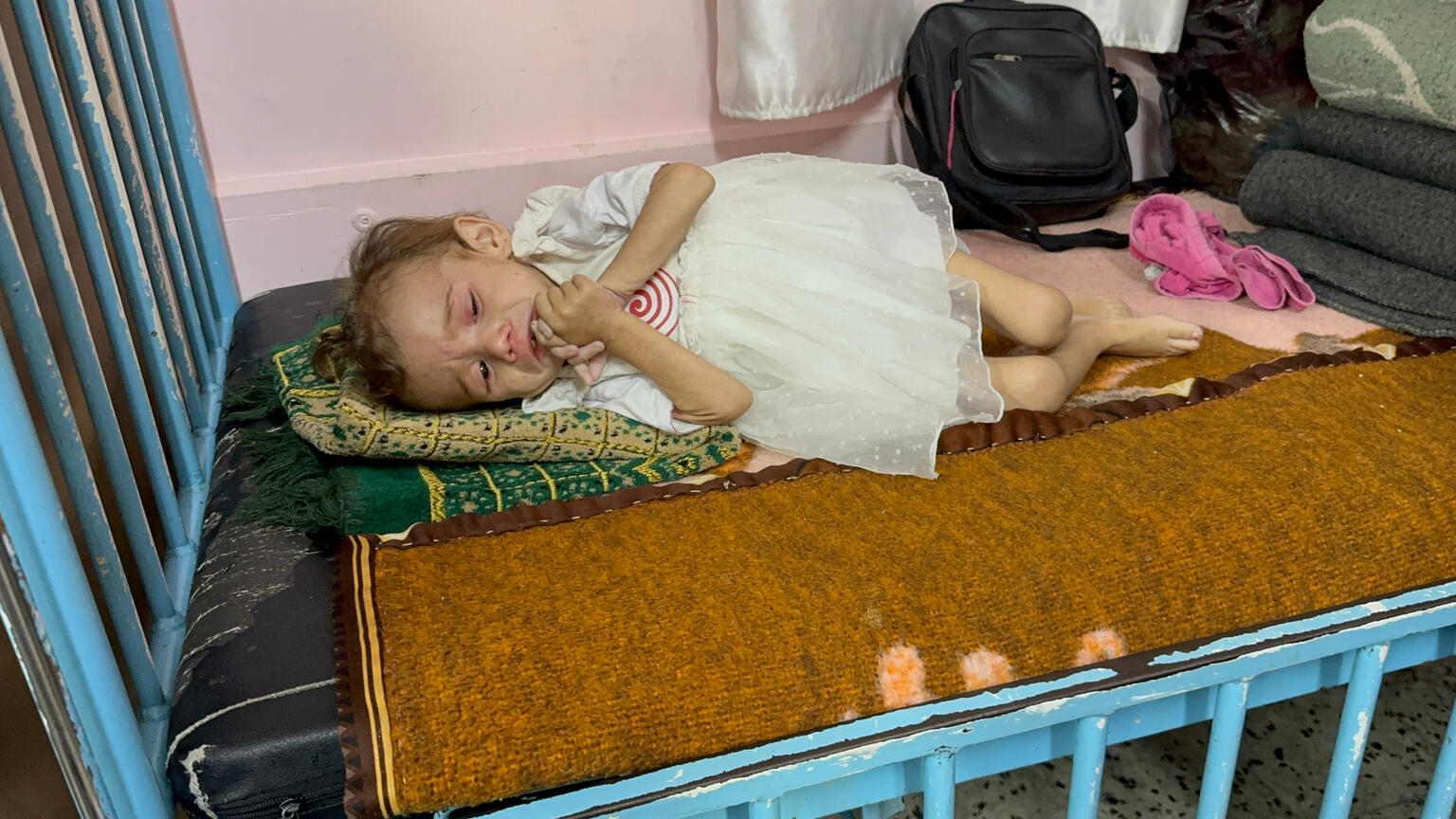 ガザ地区ハンユニスの病院で、重度の栄養不良の治療を受ける2歳のマリアムちゃん（パレスチナ、2025年6月5日撮影）